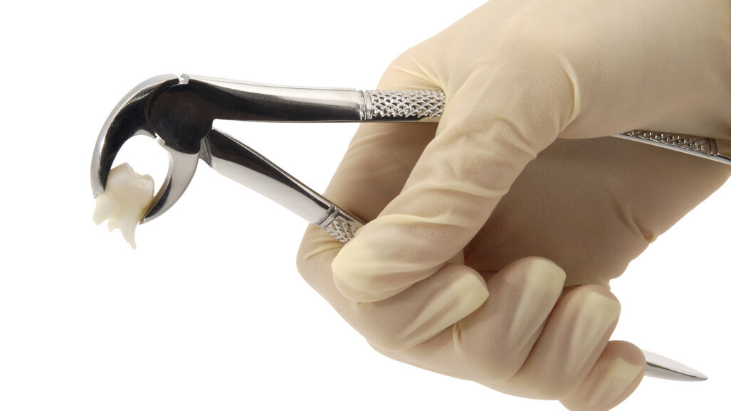 Kiezen of delen voor voetballers