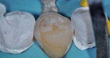 ADF 2015 : L’érosion, le nouvel ennemi ?