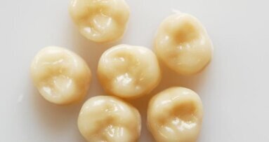 Ontwikkelpad van een nieuw kroon- en brugsysteem