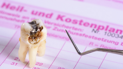 ÖZÄK veröffentlicht neuen Grenzwert für Heil- und Kostenplan