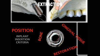 Free webinar: Esthetic protocols for rehabilitation with implants Free webinar: Esthetic protocols for rehabilitation with implants