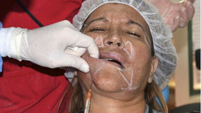 El rejuvenecimiento facial con ozono