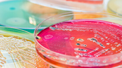 “Like bacteria hitch-hiking on the fungi”—study shows how organisms “walk” across teeth