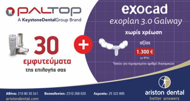 Ariston Dental – Προσφορά Exocad: Exoplan 3.0 Galway