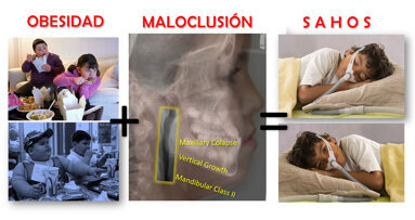 El papel del Ortodoncista en la Patología del Sueño (1)
