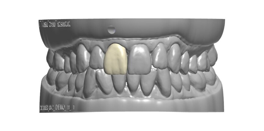 11 vestibulaire avec modele