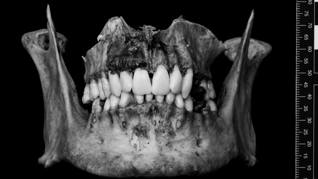 New digital 3D models for forensic odontology education