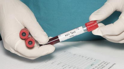 Las bacterias periodontales pueden reactivar el VIH latente