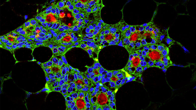 Dentale Stammzellen können milchproduzie­rende Zellen erzeugen