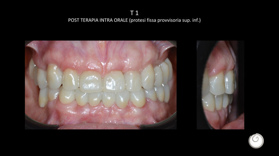 Presentazione standard di PowerPoint