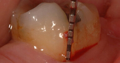 AIE propone: Caso Clinico 2