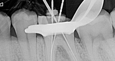 Un nuovo livello di flessibilità: F6 SkyTaper
