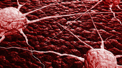 Selbstkontrolle des Immunsystems dämpft Krebsabwehr