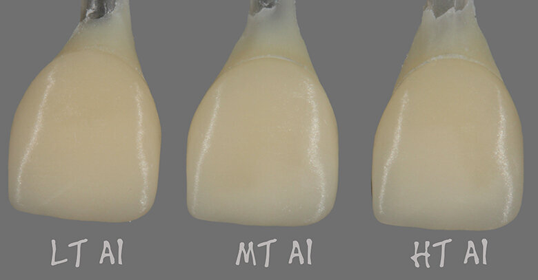 Fig. 2b: Differences in value and chroma with the effect on the shade by the abutment; the veneering ceramics touch the preparation (thickness of veneering ceramic: 0.6–0.8 mm).