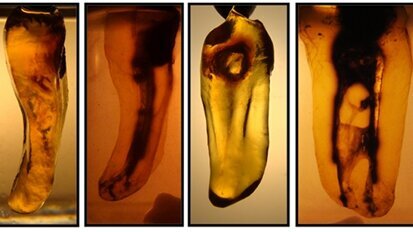 Dents transparentes : un puissant outil didactique