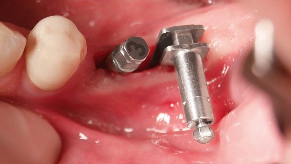 Experte erläutert Technik der Winkelmodulation