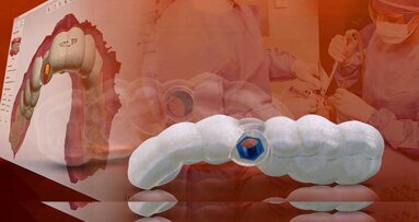 La planificación digital del tratamiento