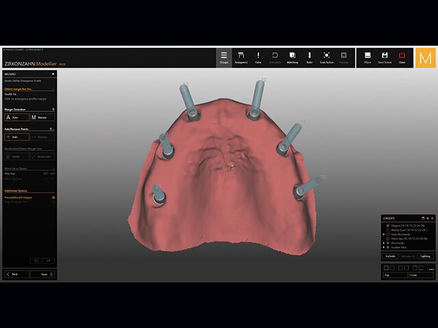 CAD software přímo ukazuje závity pro zvolený kanál ke šroubku.