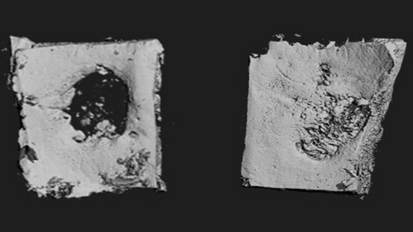 Gli scienziati creano un biopatch per rigenerare l’osso