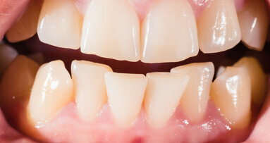 Early-life stress may lead to crooked bite