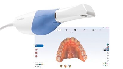 Planmeca Emerald S: escáner de alta velocidad que es fácil de usar