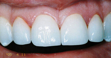 Healthy and harmonised function via computer-guided occlusal force management