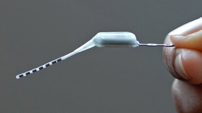 Mini-Stimulator im Oberkiefer schaltet Kopfschmerzen ab