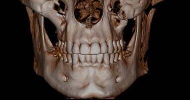 Participez au sondage : le cone beam