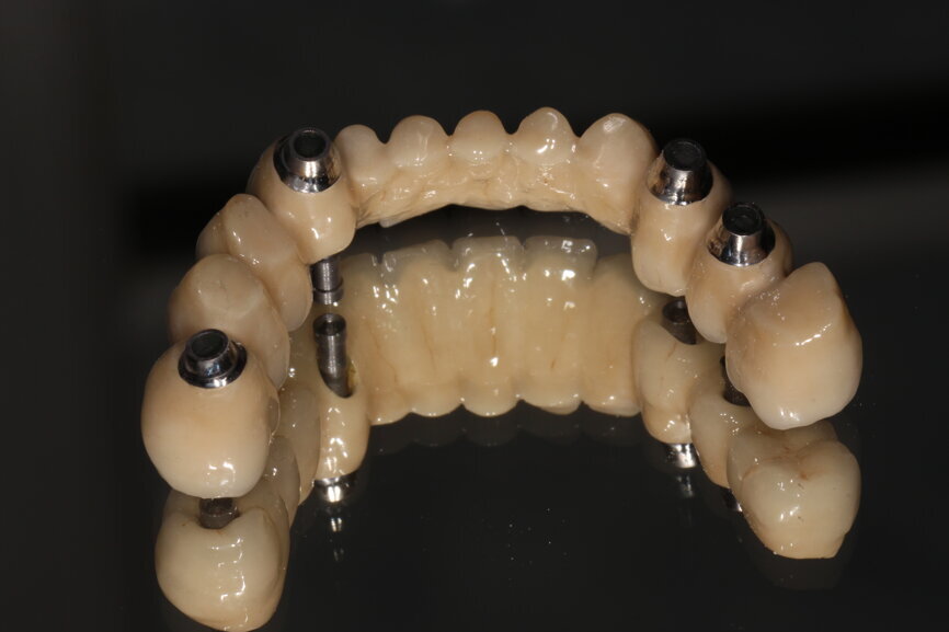Fig. 16: Createch framework fit surface.