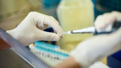 חוקרים יפניים מגלים חומר אנטיספטי חדש להילחם במחלת חניכיים