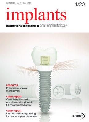 implants international No. 4, 2020 implants international No. 4, 2020