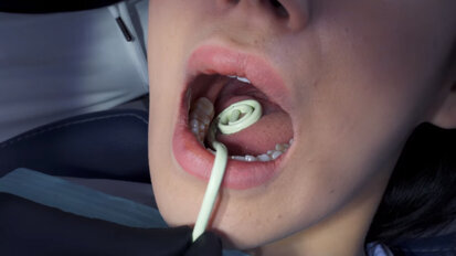 DirectaDentalGroup – Orsing Dental – Hygoformic Bio – The Flexible Saliva Ejector