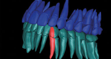 Ortodonzia 4D: dalla diagnosi morfologica al fattore tempo