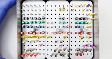 Betere bloedglucoseregulatie en minder systemische ontstekingen na wortelkanaalbehandeling