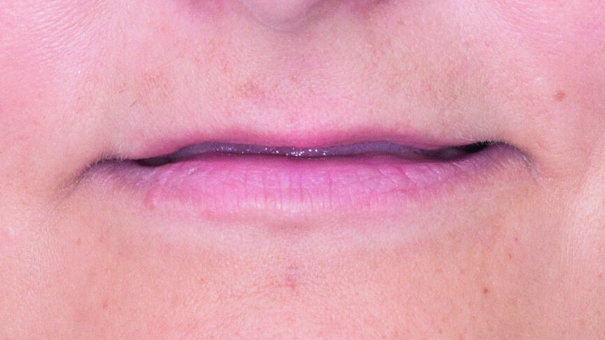 Fig. 1: Initial situation.