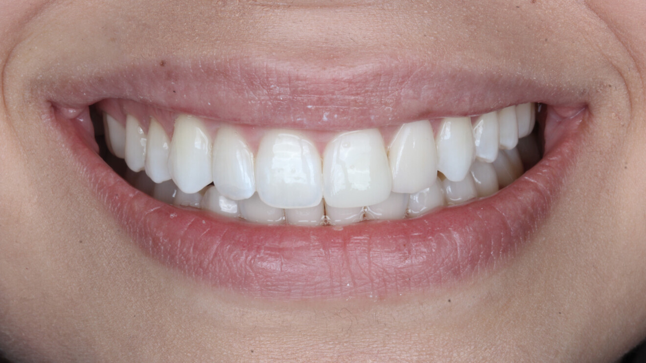 Dental photography is an excellent tool for case presentation and allows the patient to visualise his or her smile after treatment. (Image: Mahfuz Rahman)