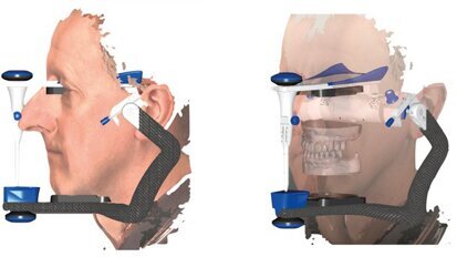 Utilizzo clinico della scansione facciale in ambito odontoiatrico