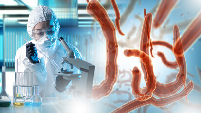 Studie zeigt Zusammenhang zwischen Darmbakterien und Karies