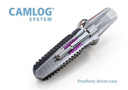 CAMLOG IMPLANT SYSTEM