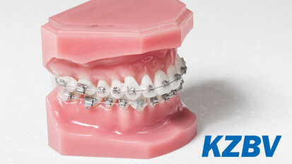 KZBV: Kein Zweifel an Sinnhaftigkeit kieferorthopädischer Behandlungen