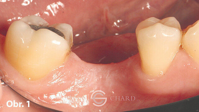 Počáteční situace