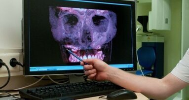 Beperkingen en valkuilen van CBCT