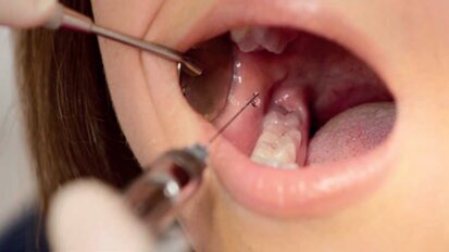 Frustracije zaradi nezadostnega anesteziranja pacientov?