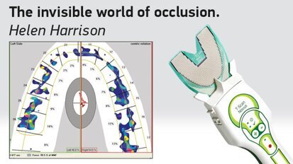 The invisible world of occlusion