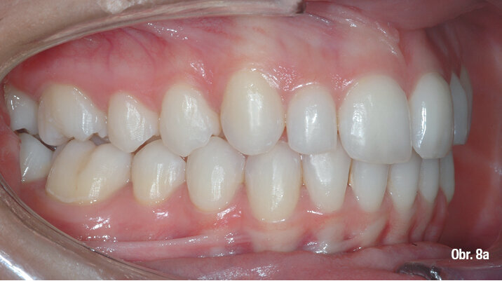 Kazuistika - popis v textu