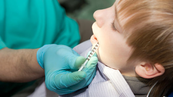 Dentale anesthesie voorkomt groei verstandskiezen