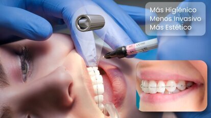 Un sistema que revoluciona la biomecánica en el movimiento dental