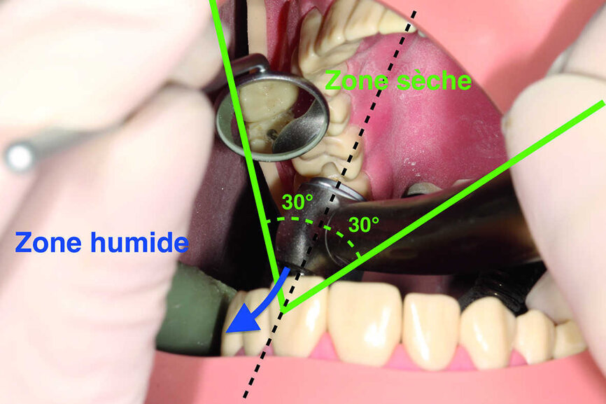 Fig. 6 : Il existe une zone dans laquelle nous pouvons travailler avec un miroir sec. 