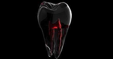 Sesja „Endodoncja” na targach Krakdent 2023