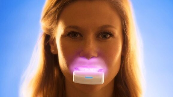 Intra-orale lichttherapie kan duur orthobehandeling verkorten